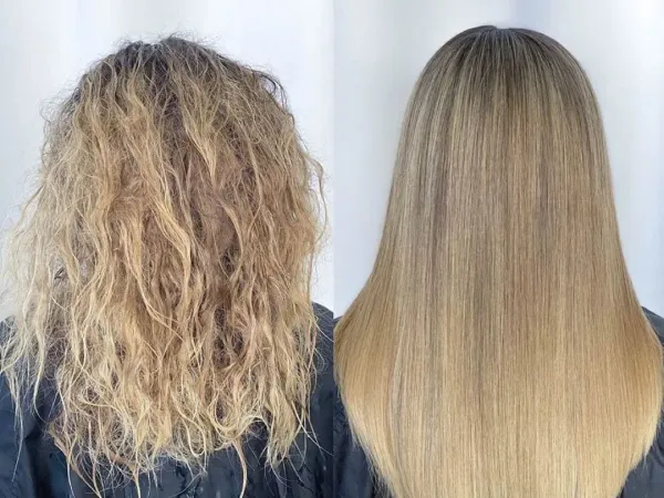 Resultado de Nanoplastia sin formol antes y después en Saga Beauty Bar
